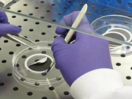 Distacco filtri in teflon in ambiente sterile resz